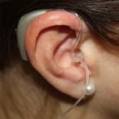 Hearing aid fitting in the ear.